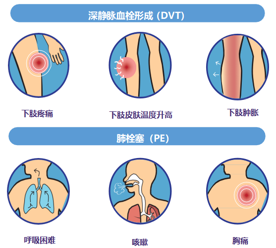 久坐久站族注意！踝泵运动：预防静脉血栓栓